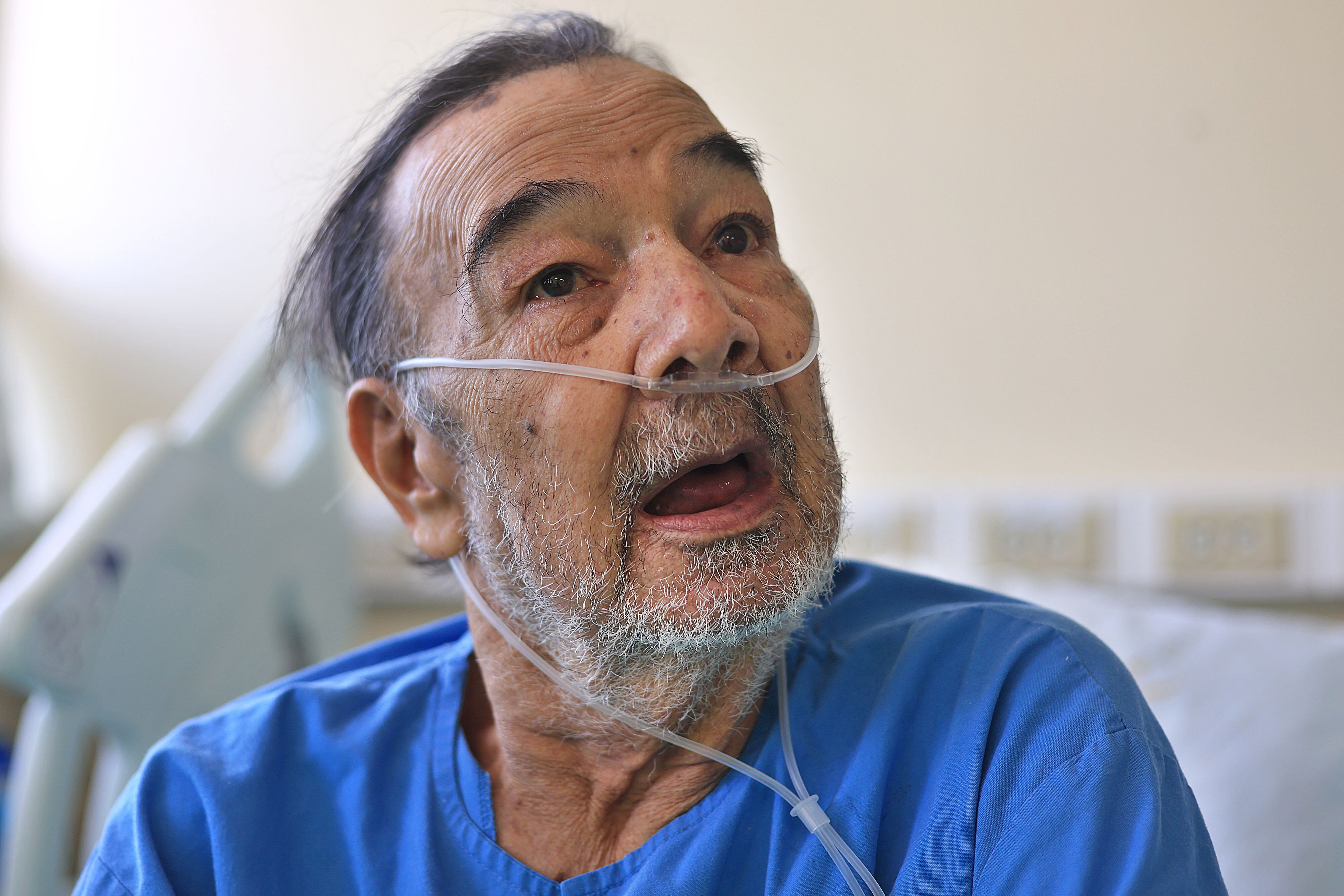 Retrato de un adulto mayor. Viste camisa celeste, tiene una cánula para respirar. La barba es incipiente.