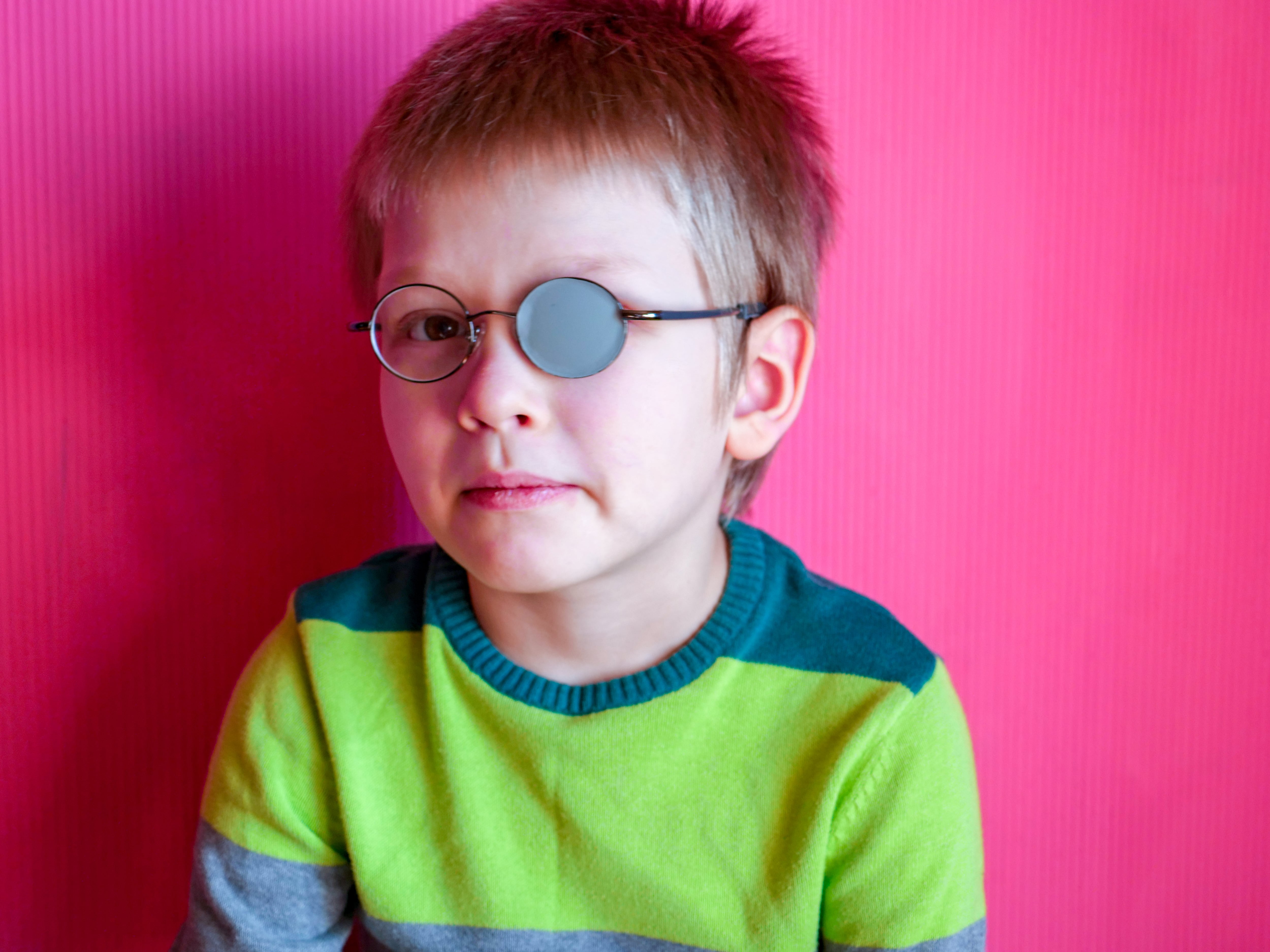 Niño con anteojos y un parche sobre el ojo izquierdo para corregir estrabismo, bizco