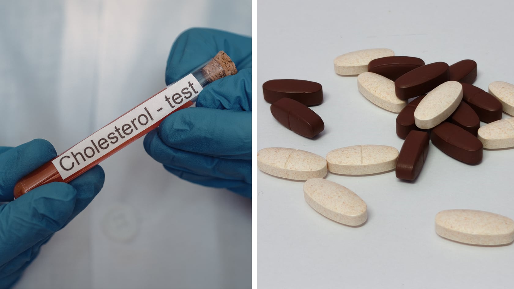 Especialista explica cómo funcionan las estatinas, cuáles son los niveles recomendados de colesterol LDL y qué riesgos se pueden prevenir con tratamiento.