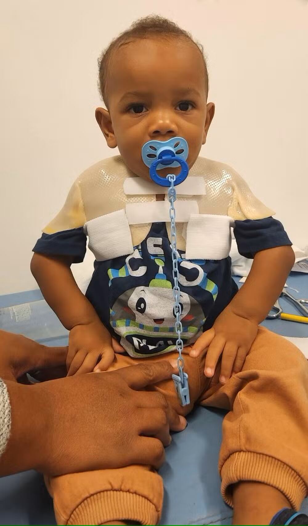 João Pedro, de 1 año y 10 meses, nació con artrogriposis. Hoy juega, se alimenta solo y avanza en su tratamiento sin haber pasado por cirugía.