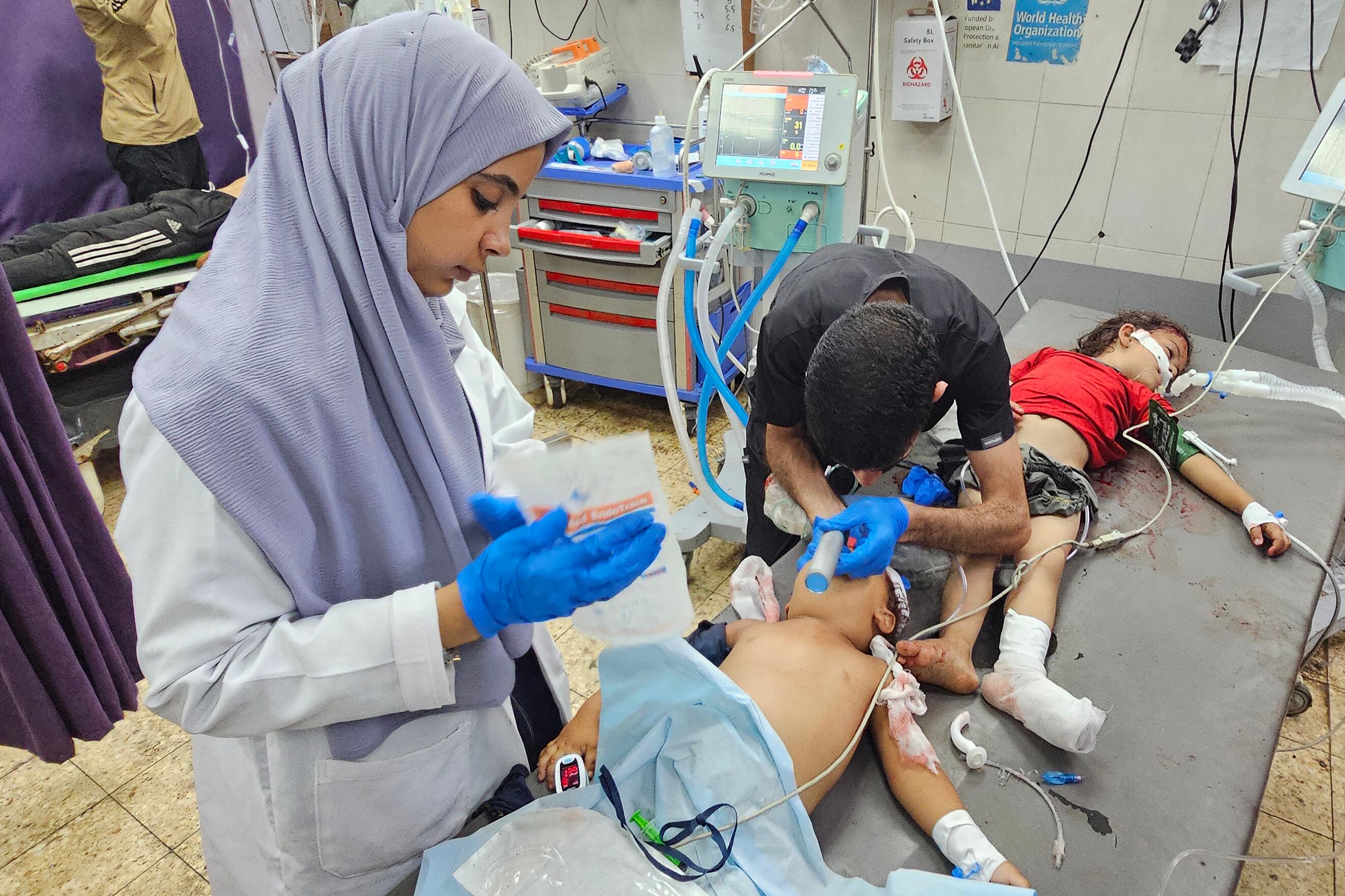 21 niños han muerto debido a la desnutrición y el hambre en diferentes zonas de la Franja de Gaza, en las últimas 72 horas.