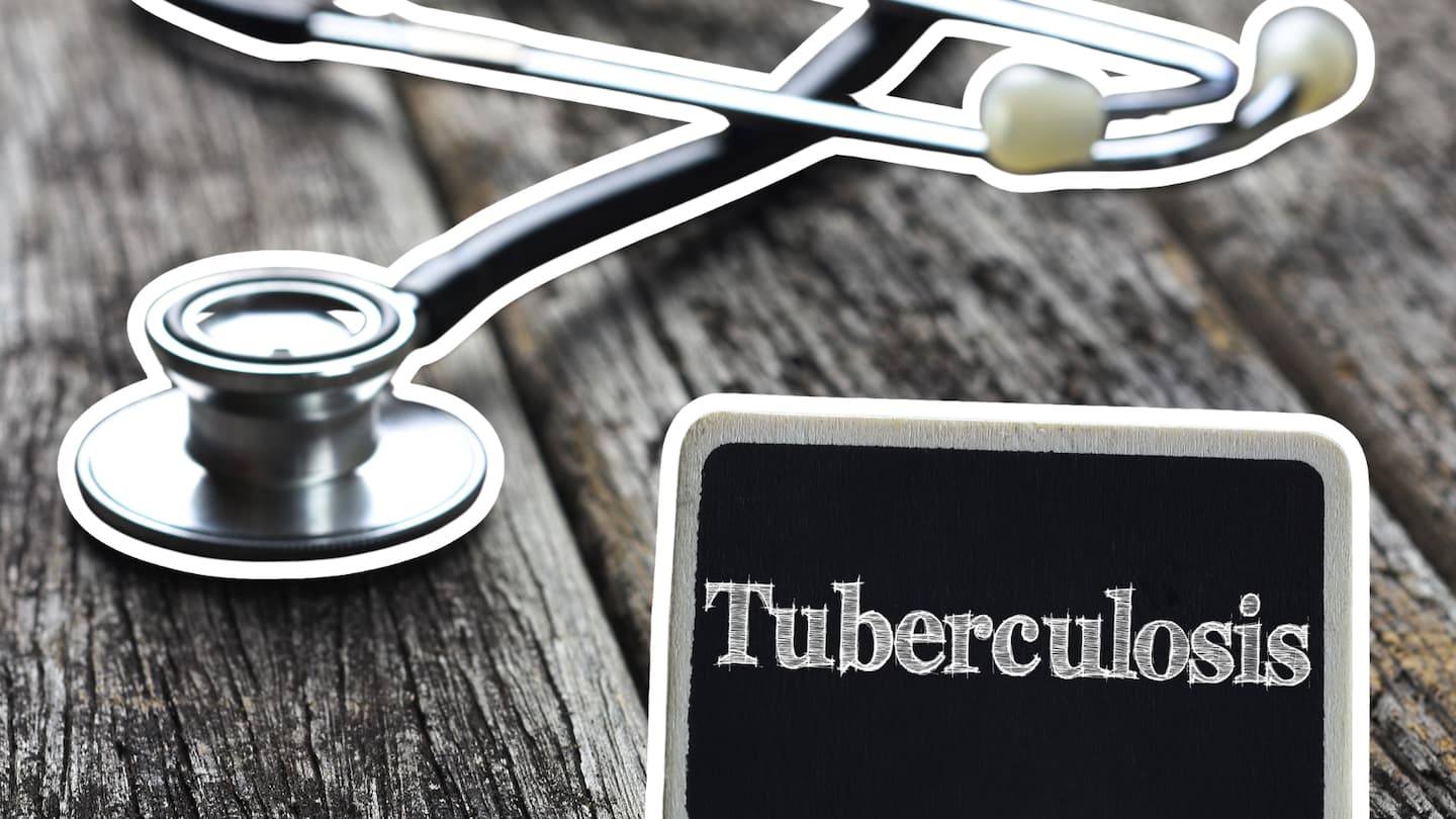 Tuberculosis Mi bienestar