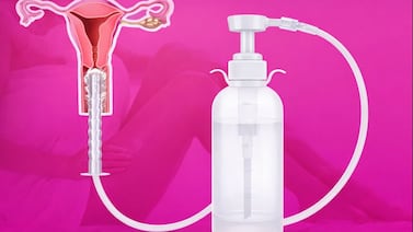 Salud advierte riesgos por uso de todo tipo de duchas vaginales