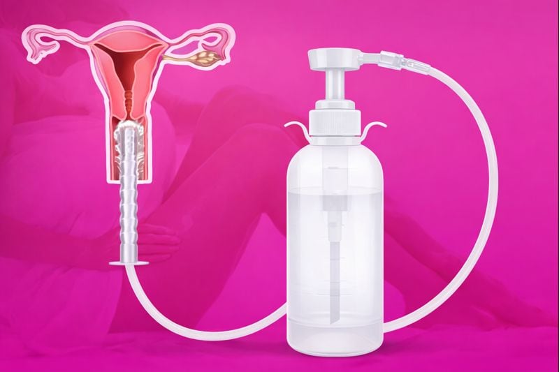 El uso de duchas vaginales se asocia con infecciones y otros efectos adversos.