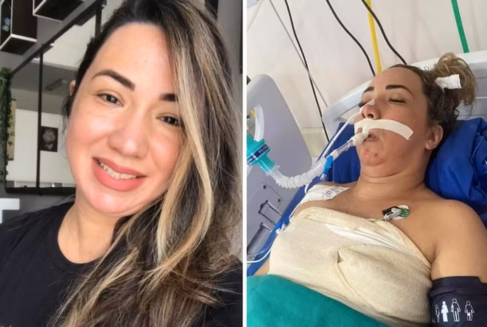 Madre de 40 años entró en coma por ACV y fue desahuciada. Logró recuperarse tras una crisis que la dejó al borde de la muerte.