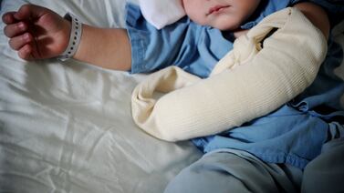 Bebé de un año sufre quemaduras con agua hirviendo en la cocina de su casa