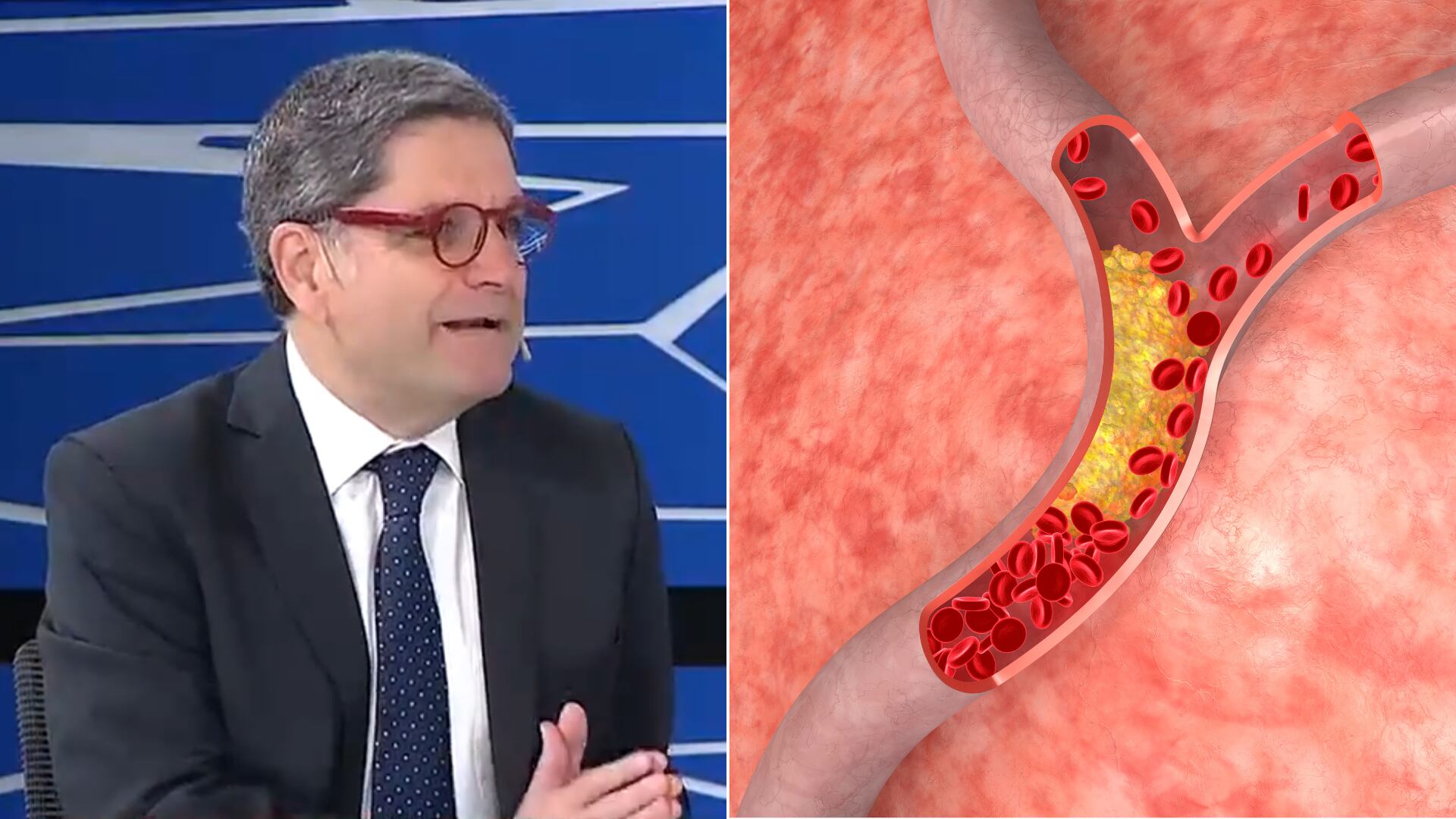 El tratamiento integral del colesterol incluye hábitos sanos, control médico y estatinas en casos necesarios, según Jorge Tartaglione.