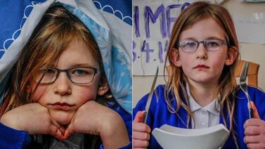 Conozca la adolescente que no siente dolor, hambre ni sueño y sorprende a la ciencia