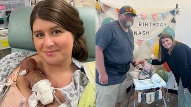Pesó 280 gramos y superó todos los pronósticos: el bebé más prematuro del mundo celebra su primer año