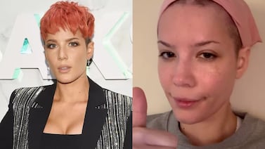 Halsey revela en su nueva canción que padece lupus y leucemia
