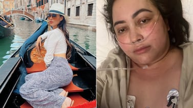 Mujer afectada por cirugía de glúteos lanza alerta: ‘Desconfíen de resultados sin riesgo’