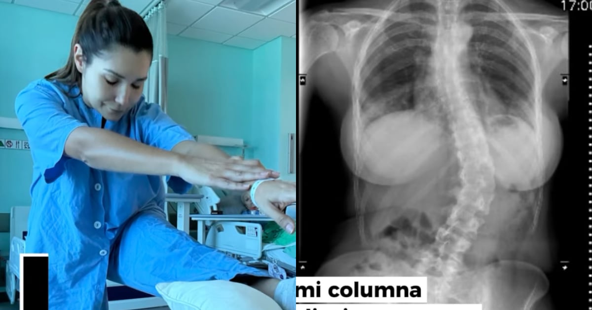 Ginnés Rodríguez mostró cómo luce su columna.