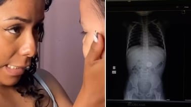 Niña de 3 años sorprendió a su madre con una confesión inesperada y una radiografía confirmó la verdad