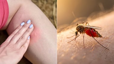Mosquitos no eligen al azar: estudio revela qué los atrae y cómo evitar picaduras