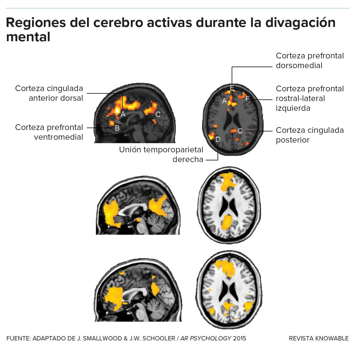 Un gráfico del cerebro