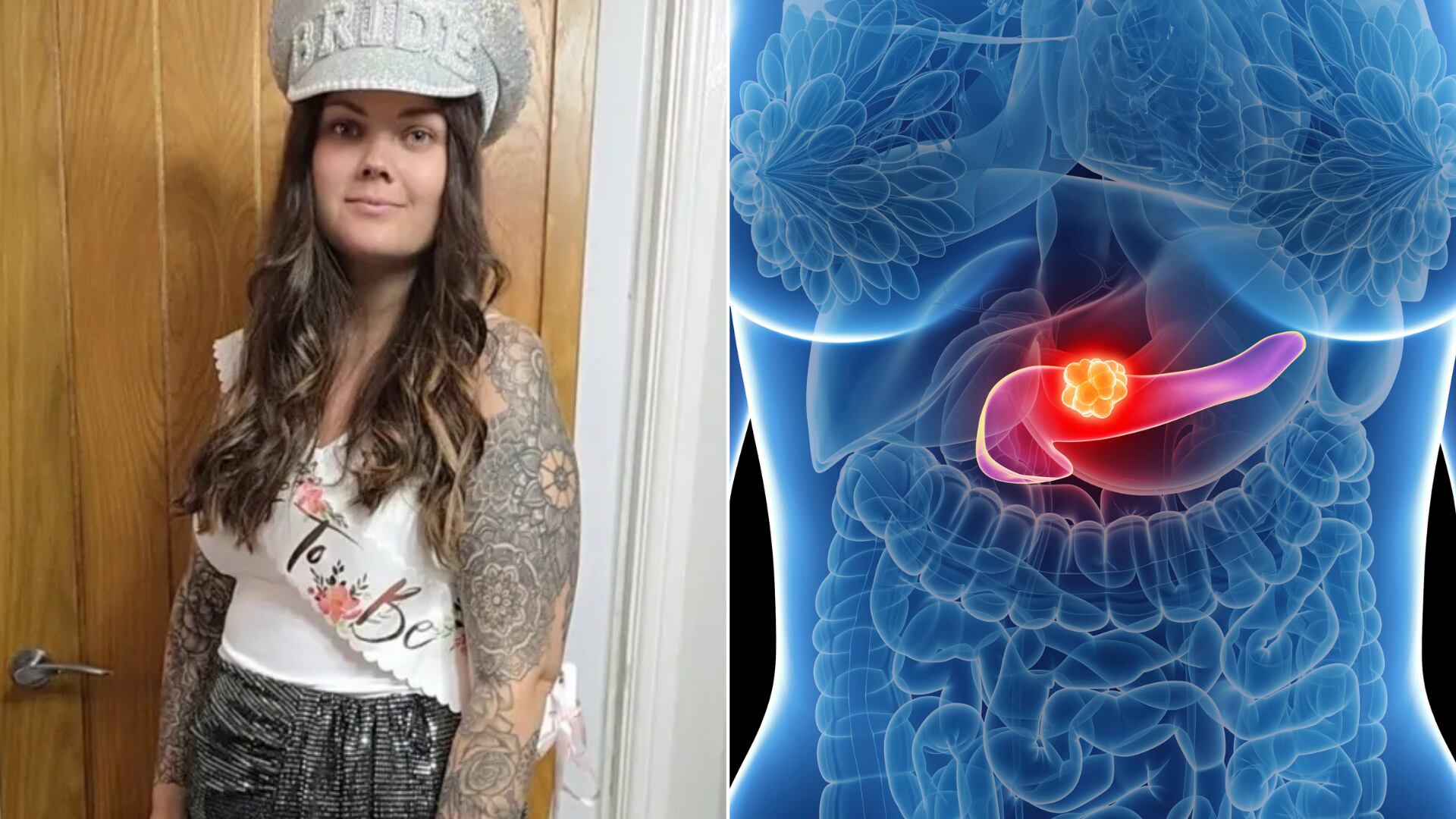 Collins enfrentó retrasos en su diagnóstico por ser joven; cuando se confirmó el cáncer, ya había hecho metástasis al hígado.