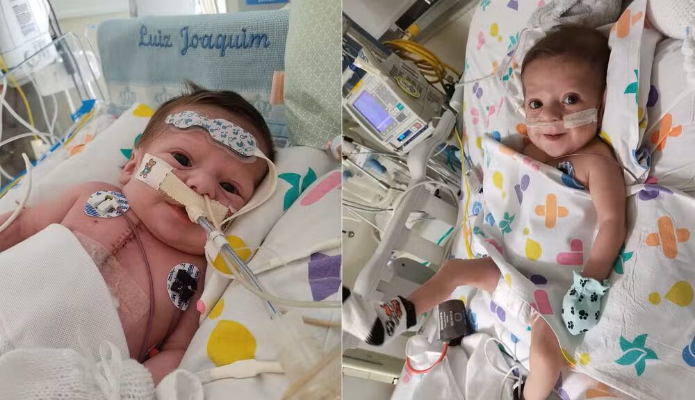 La condición cardíaca del menor lo llevó a cirugías complejas y secuelas neurológicas, pero hoy mantiene estabilidad y avances físicos.