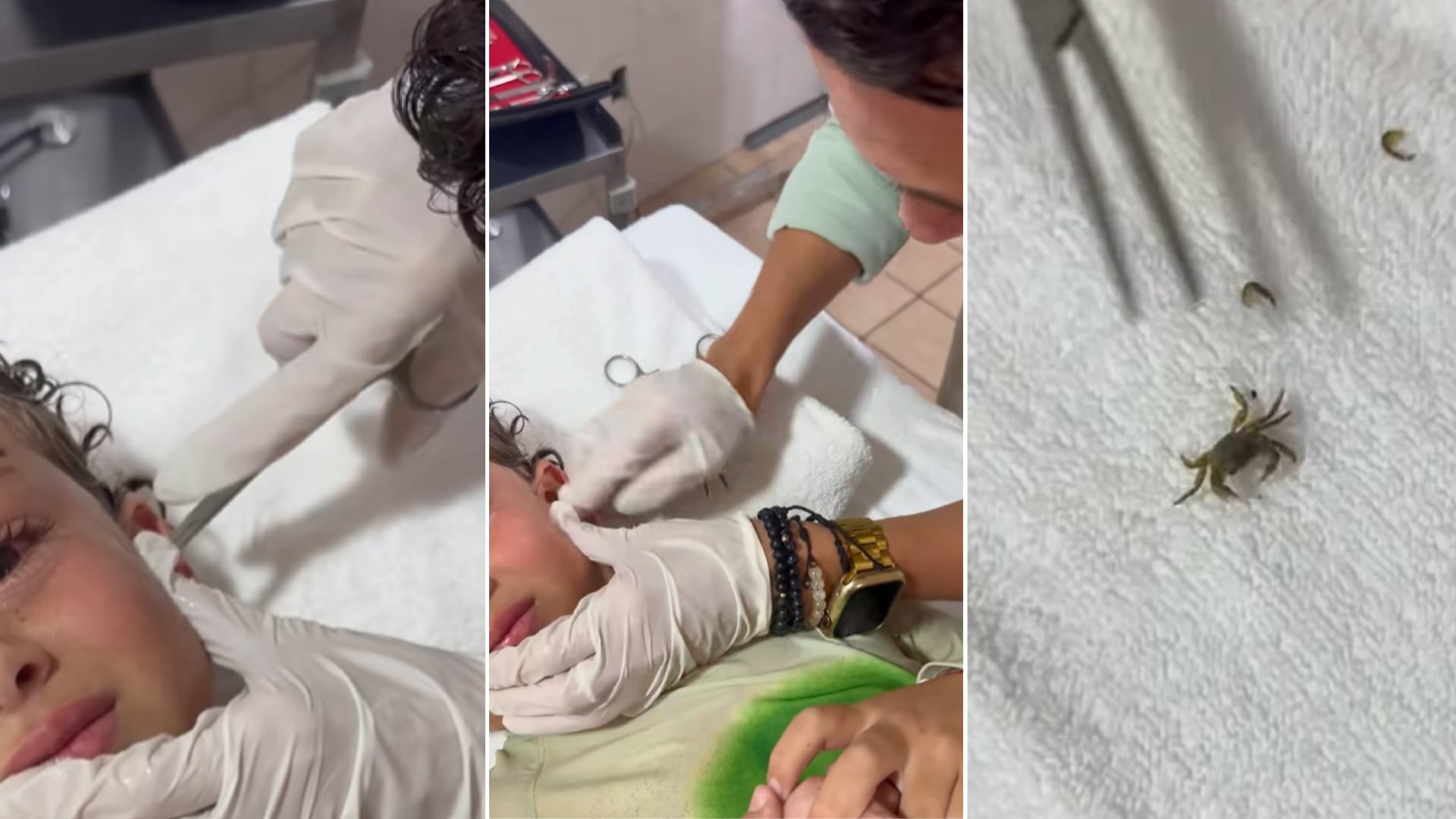 Un menor sintió molestias tras nadar en el mar. Los médicos encontraron un cangrejo vivo dentro de su oído. El caso fue grabado y viralizado.