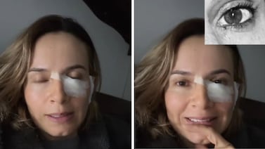 Pensó que tenía un lunar, pero era un cáncer; así se dio cuenta: ‘Da miedo’