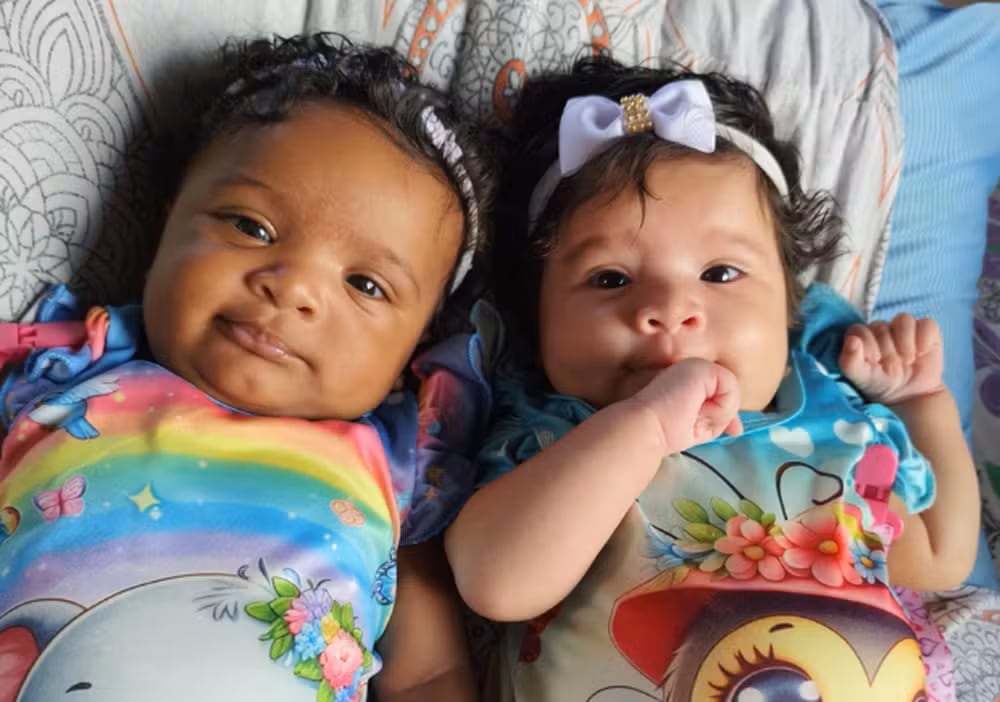 Maryelle y Maylla, gemelas nacidas en São Luís, Brasil, se volvieron virales por su color de piel distinto. Su madre compartió su historia para visibilizar la diversidad genética y apoyar a otras madres de gemelos.