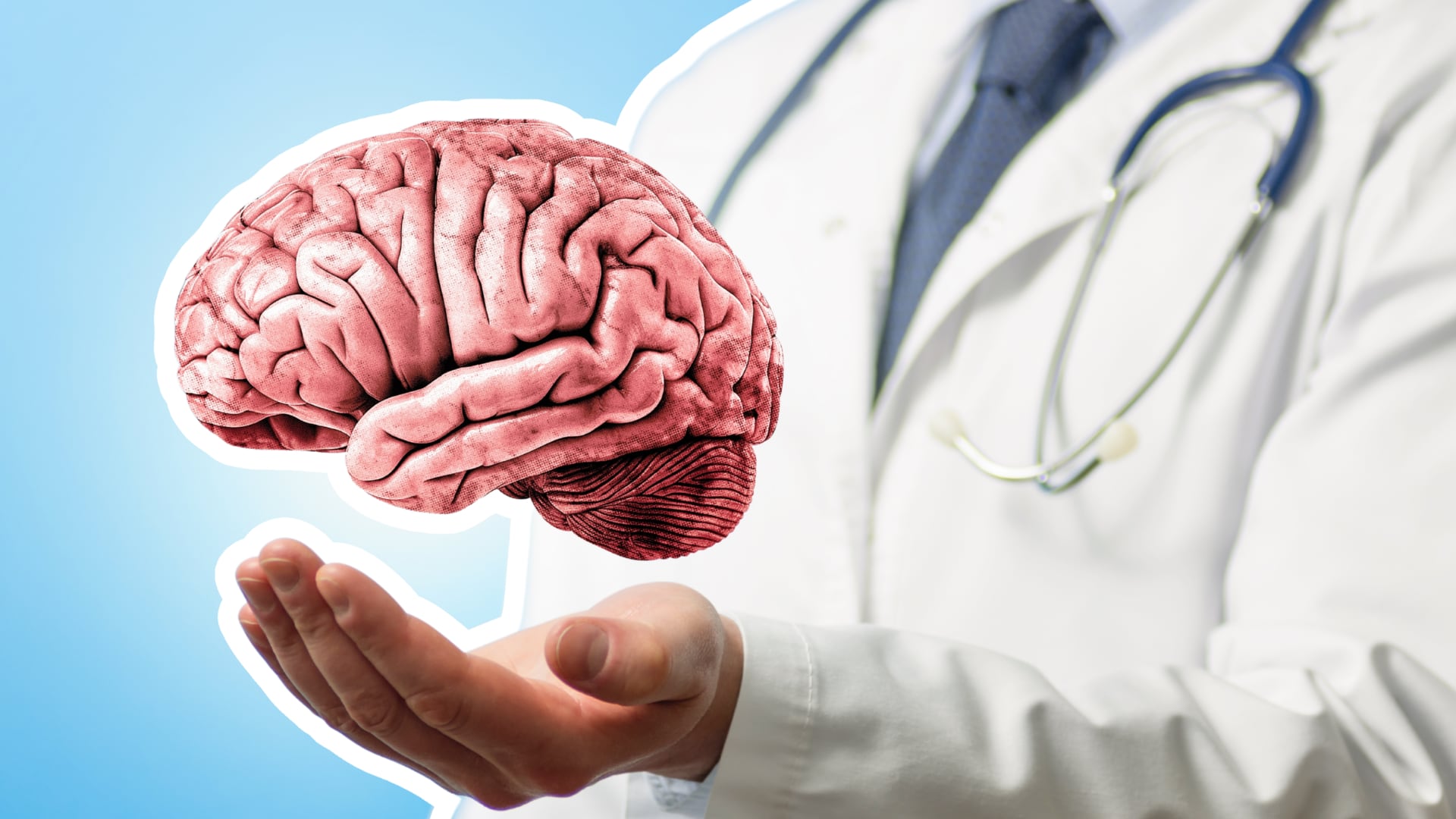 La epilepsia afecta a cerca de 50 millones de personas en el mundo, según la OMS.