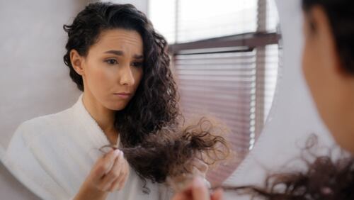 cabello y hormonas Revista Perfil