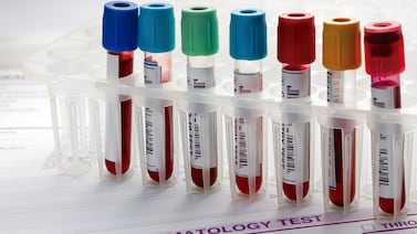 ¿Cuál es el nuevo tipo de sangre ultra raro detectado en tres personas en Tailandia?