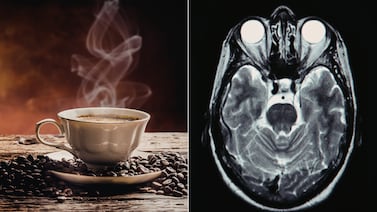 ¿Dos o tres tazas al día? Estudio analiza el impacto del café en la salud del cerebro