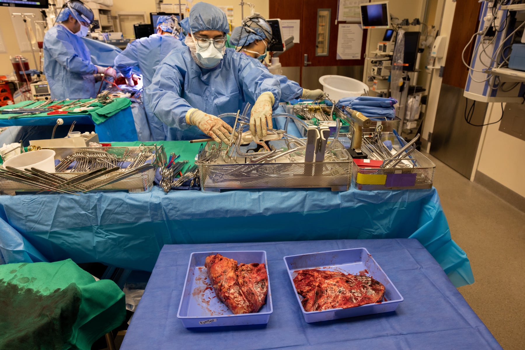 Especialistas de Northwestern mantuvieron con vida a un paciente sin pulmones durante 48 horas mediante un sistema artificial mientras esperaban un trasplante.