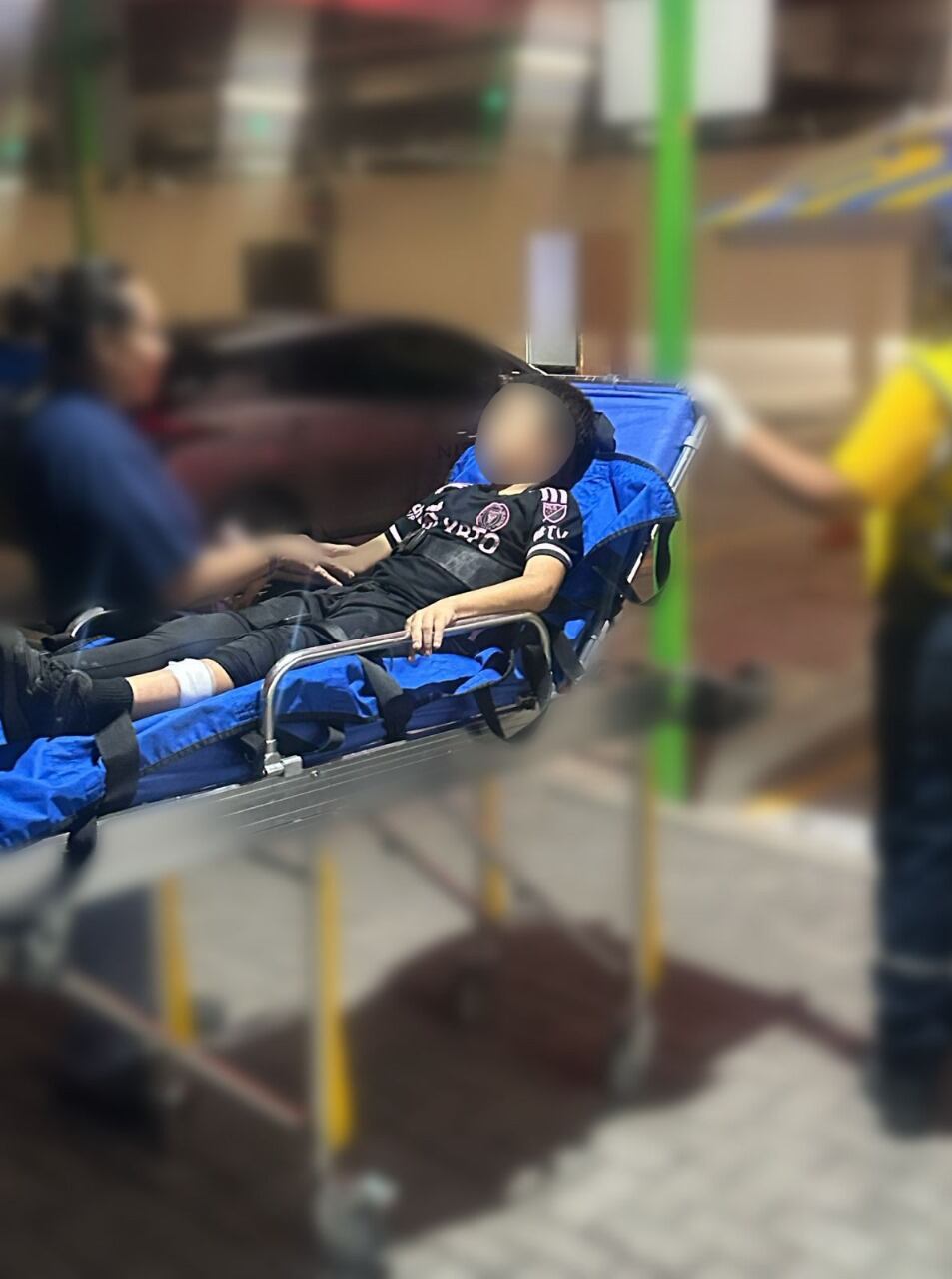 Imagen de identidad protegida de niño atacado por un perro en centro comercial