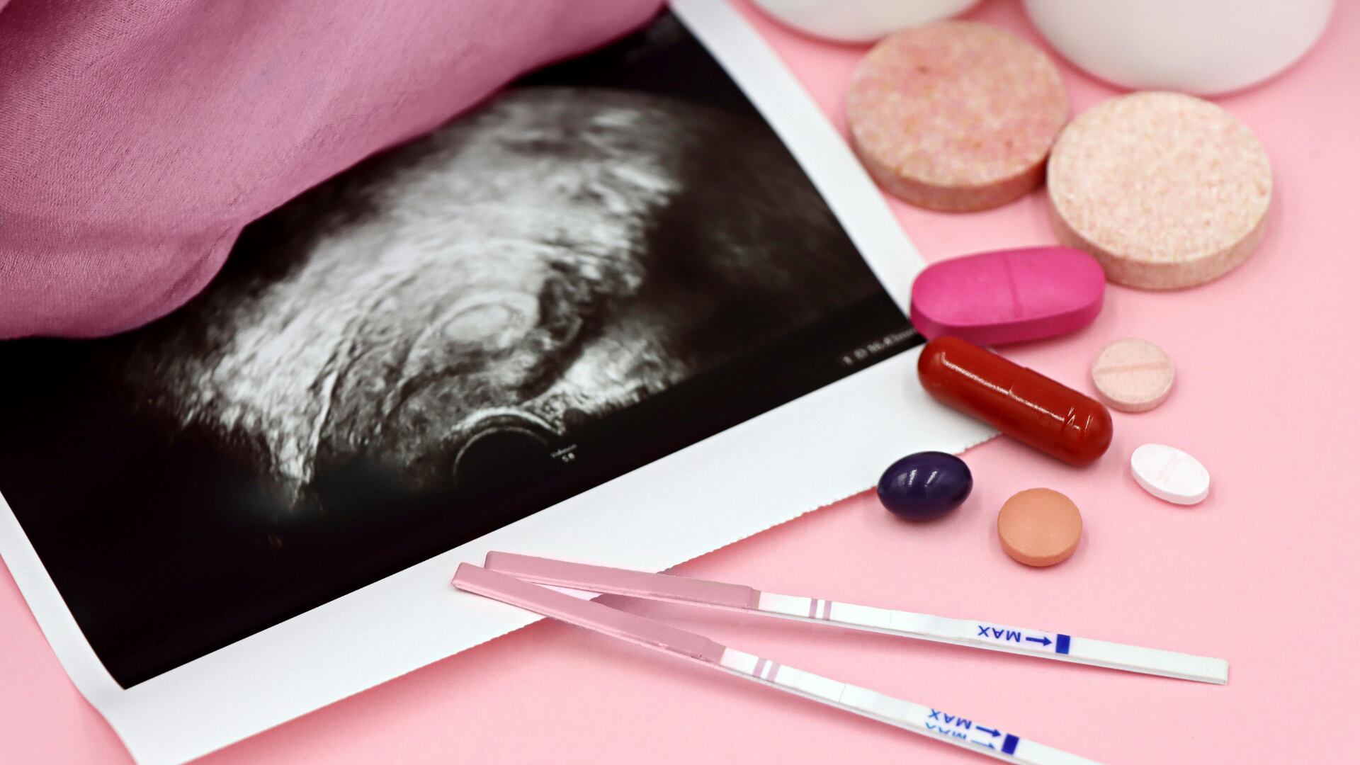 Una investigación asocia el THC en el organismo femenino con más defectos cromosómicos en óvulos usados en tratamientos de fertilidad in vitro