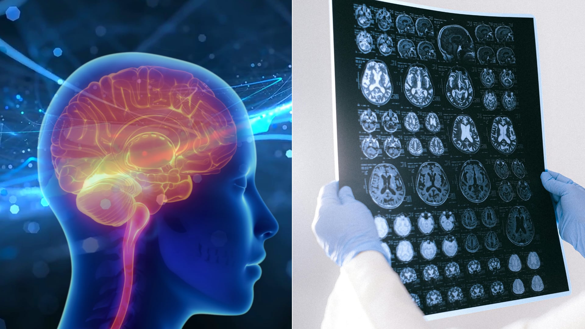 El movimiento diario fortalece el cerebro y reduce el riesgo de deterioro cognitivo desde edades tempranas.