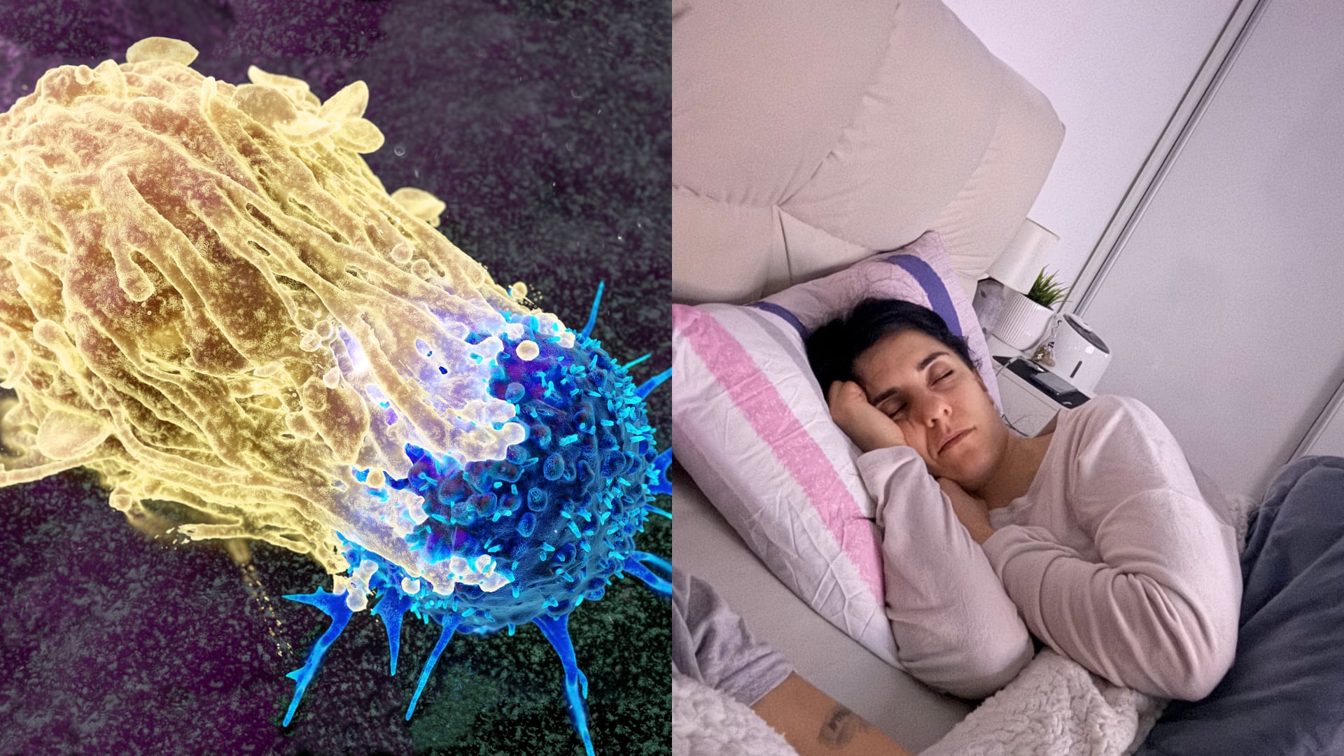 Los bloqueos respiratorios nocturnos reducen la capacidad del cuerpo para destruir células tumorales. El uso constante de la máquina CPAP reduce la mortalidad.