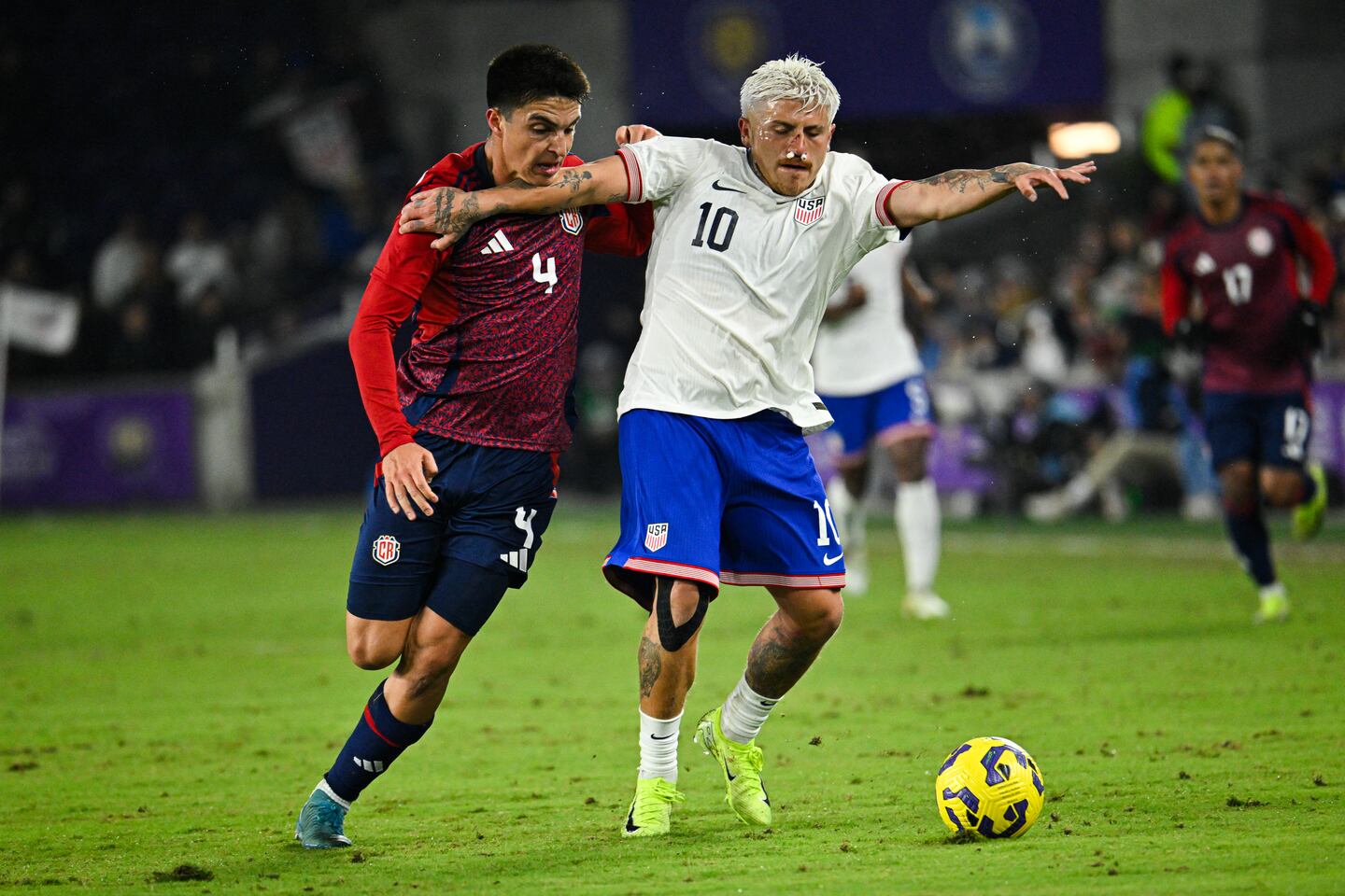 La impactante ‘herida de guerra’ que le quedó a un jugador en partido ...