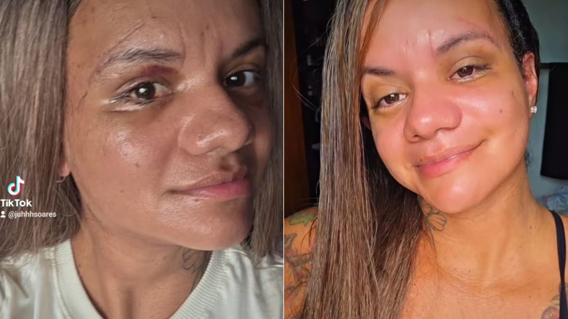 Juliana mostró su rostro tras un mes de cirugía reconstructiva. Fue atacada por Igor Cabral con 61 golpes. El exjugador brasileño continúa detenido.