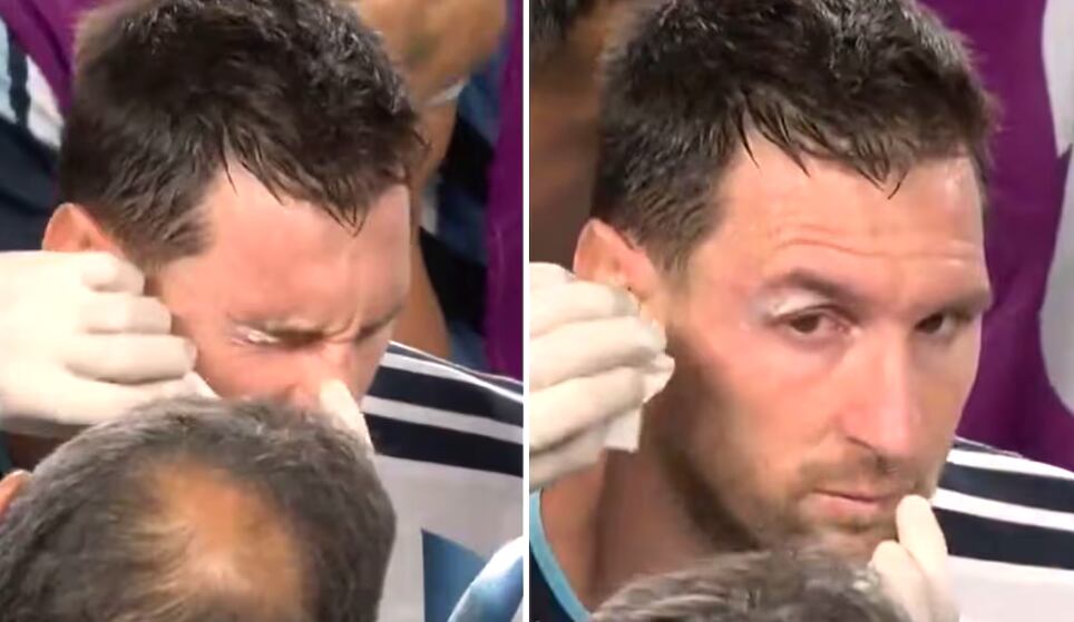 Lionel Messi fue atendido en varias ocasiones durante el partido entre Argentina y Suiza, por un golpe involuntario que recibió en el ojo.