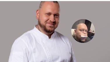 ‘El chef más viral de Costa Rica’ se operó la nariz: ‘Tenía los tabiques cerrados y sinusitis severa, con riesgo de infarto’