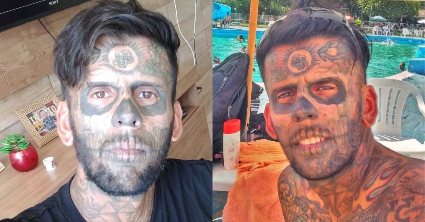 Vea el impactante cambio del hombre que decidió borrarse más de 170 tatuajes que cubrían el 95% de su cuerpo