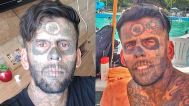 Vea el impactante cambio del hombre que decidió borrarse más de 170 tatuajes que cubrían el 95% de su cuerpo