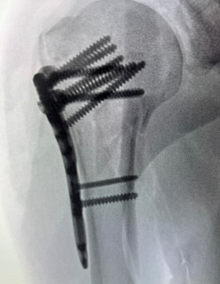 Bernal Arce Salas
Meridiano Deportivo
Programa Deportivo
Accidente de bicicleta
5 de febrero del 2026
Cortesía Bernal Arce
