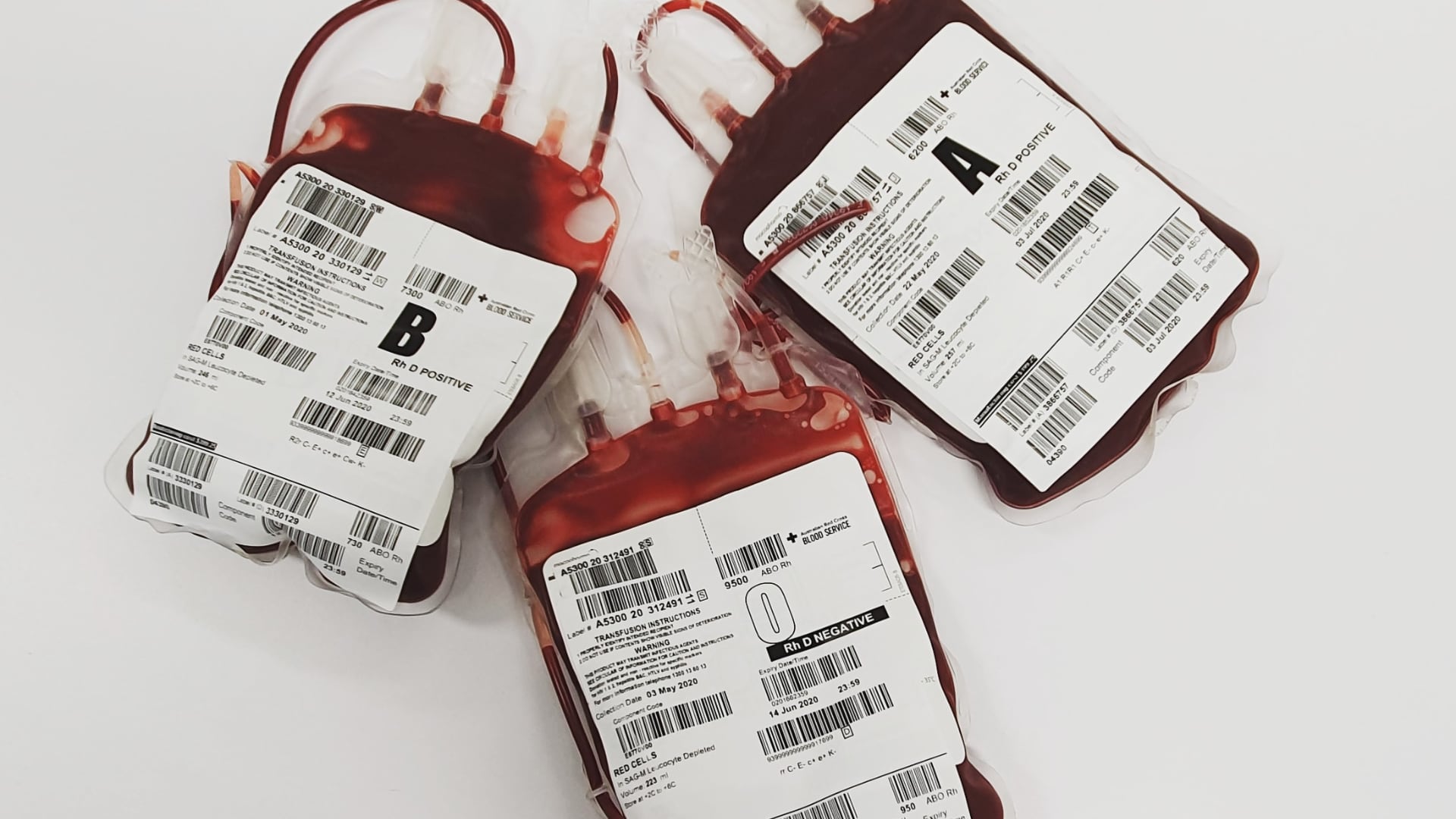 Las personas con sangre distinta al grupo O mostraron mayor riesgo de infarto, mortalidad cardiovascular y cáncer gástrico, según un estudio científico.