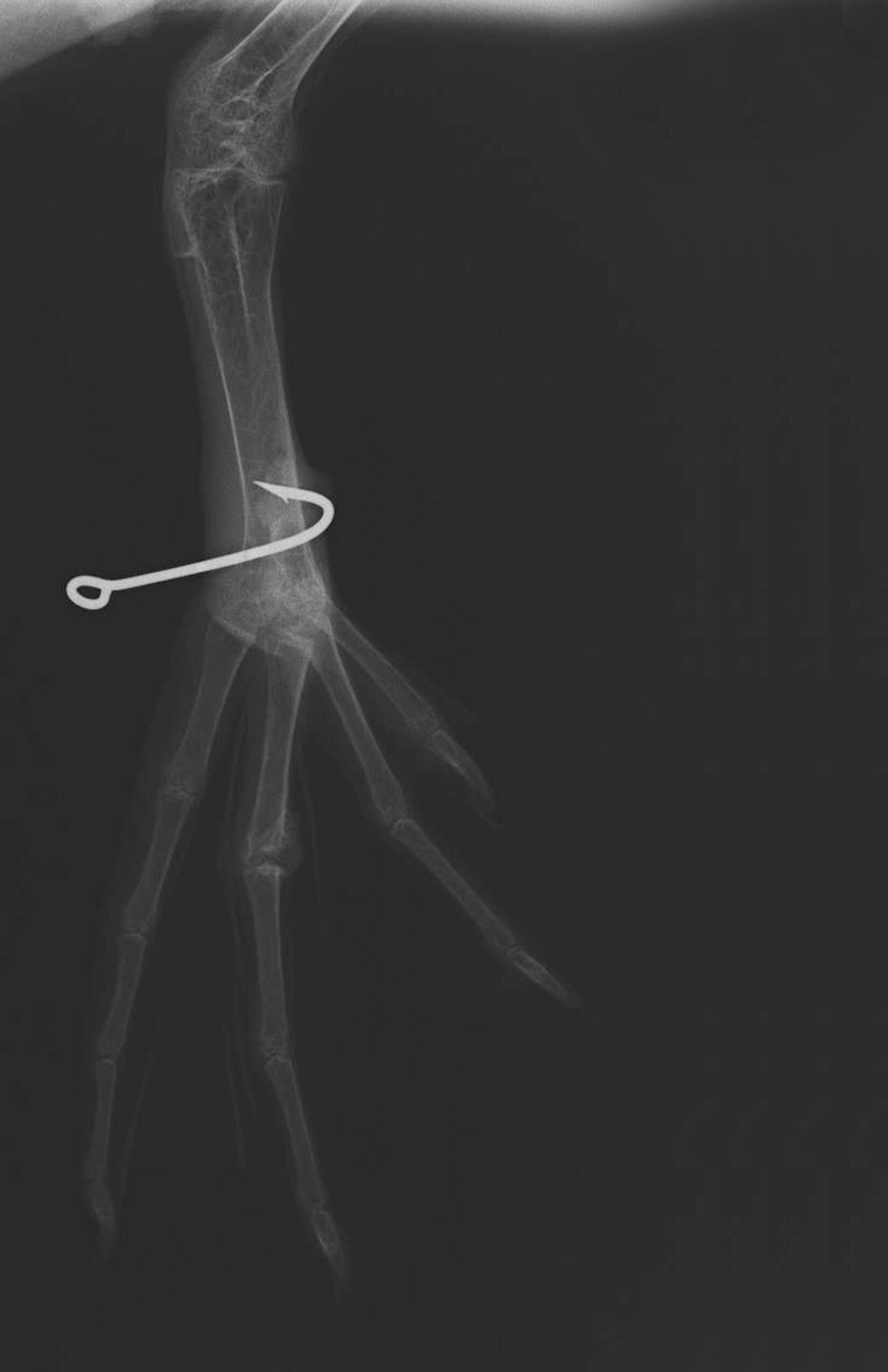 Un pelícano con un anzuelo de pesca alojado en su pata en la radiografía 'Anclado'.