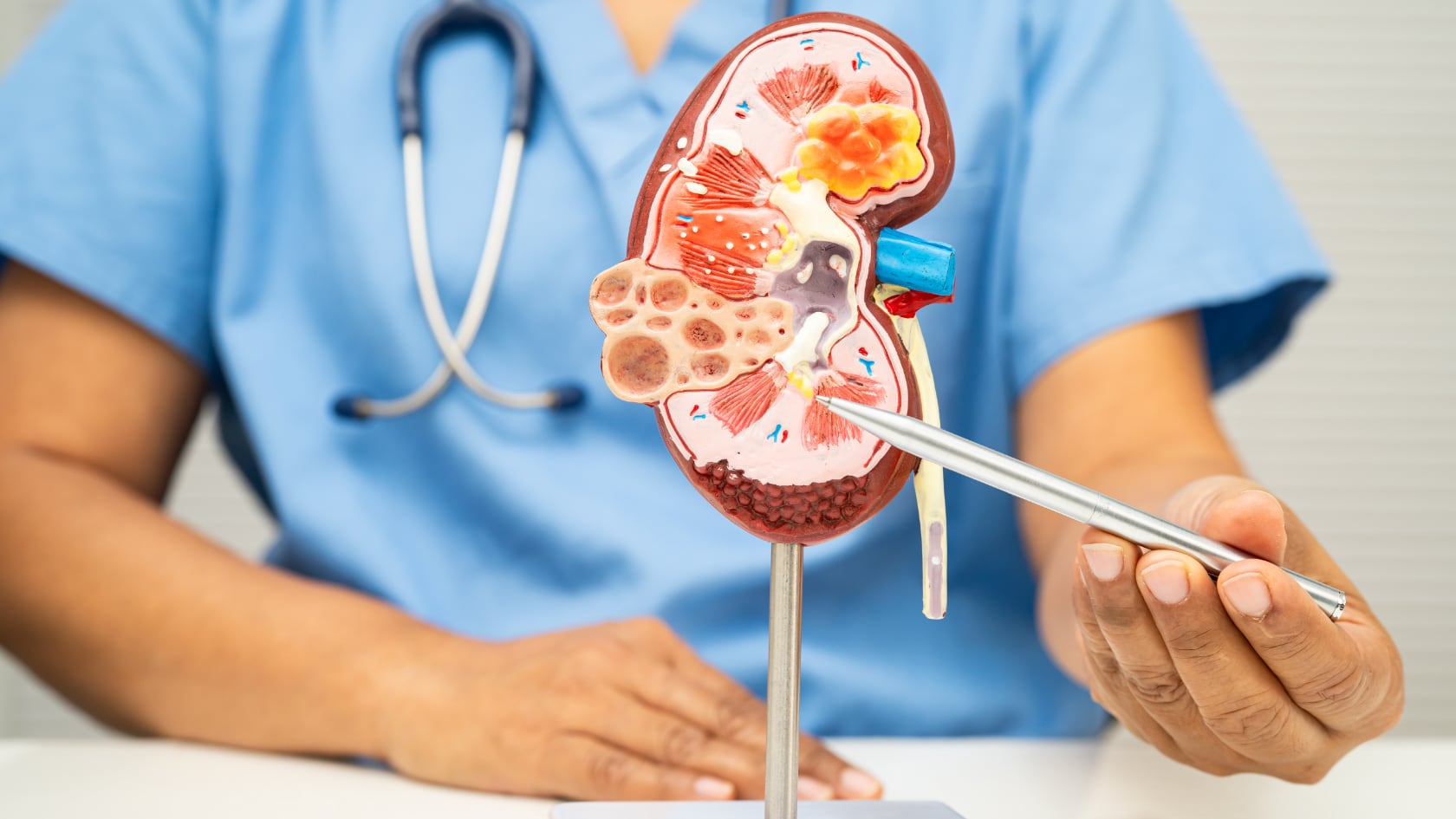 Científicos hallaron que riñones enfermos envían partículas tóxicas al corazón, lo que eleva el riesgo de insuficiencia cardíaca en pacientes con enfermedad renal crónica.