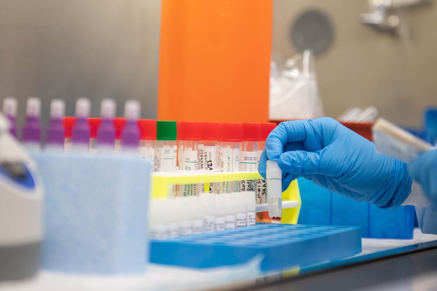 Los laboratorios privados aseguran que el desabastecimiento de equipo médico necesario para realizar la prueba, como guantes, mascarillas N-95 y caretas, botas y demás artículos desechables incrementan los costos de las pruebas del COVID-19.