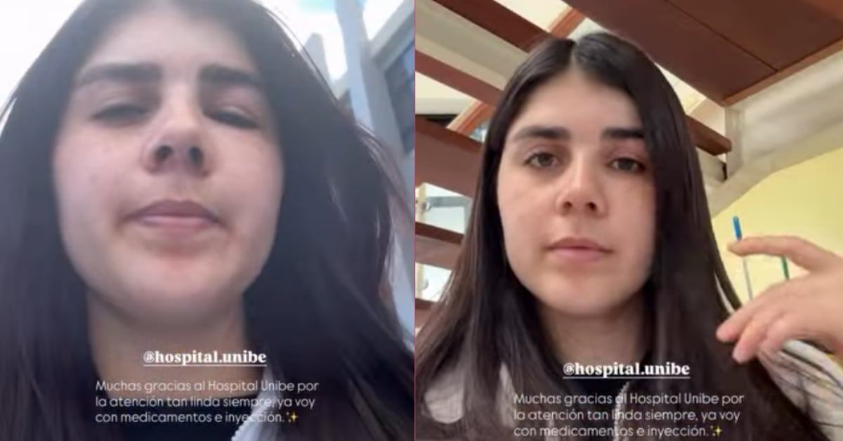 Katherine González mostró las consecuencias que le causan sus alergias.