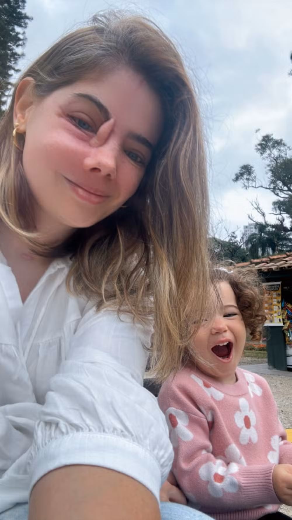 Durante su tratamiento, su mayor temor no era la enfermedad, sino la posibilidad de que su hija creciera sin ella.