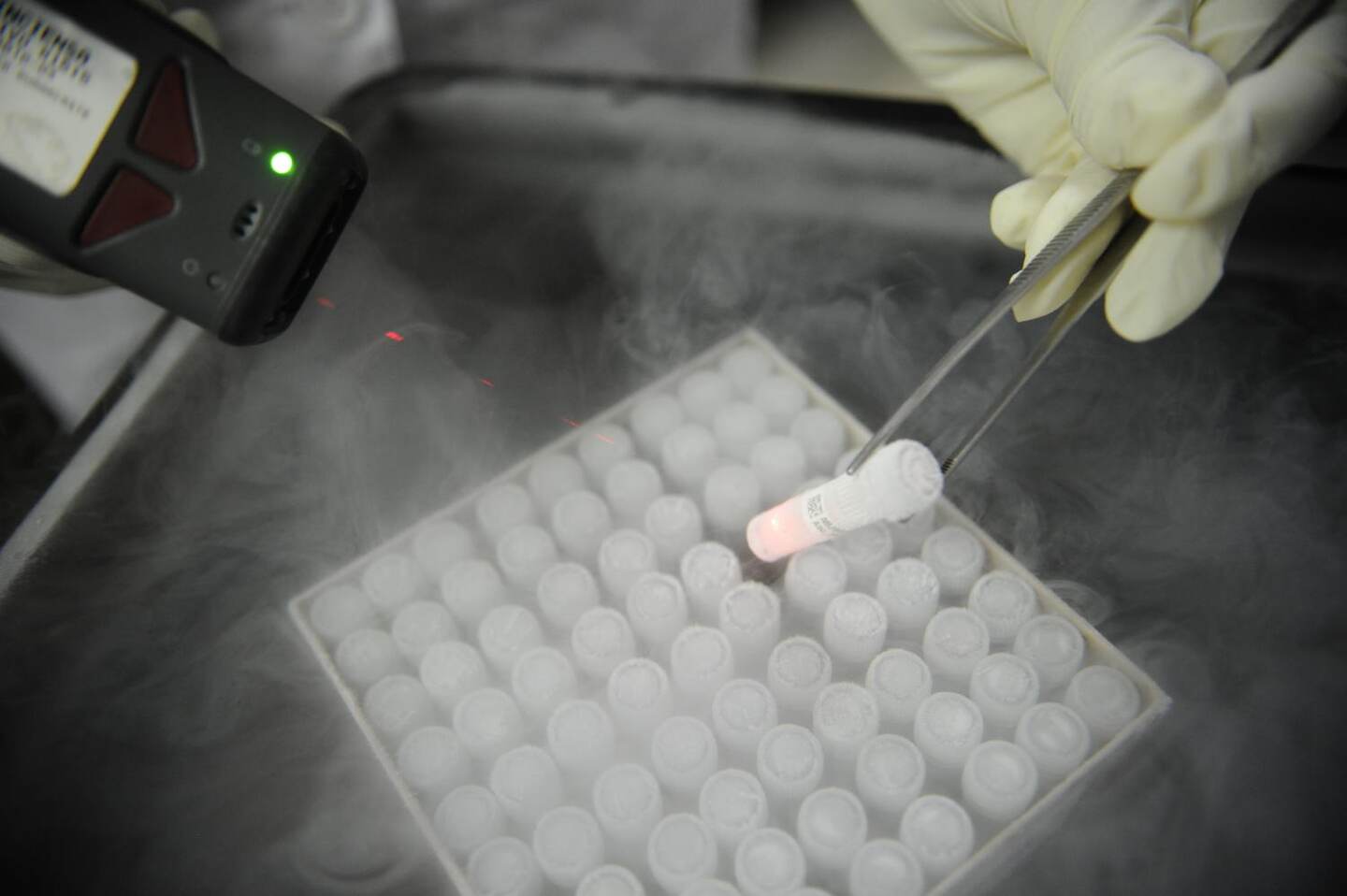 En el laboratorio de la ACIB también se realizan pruebas de muestreo genético del virus VPH.