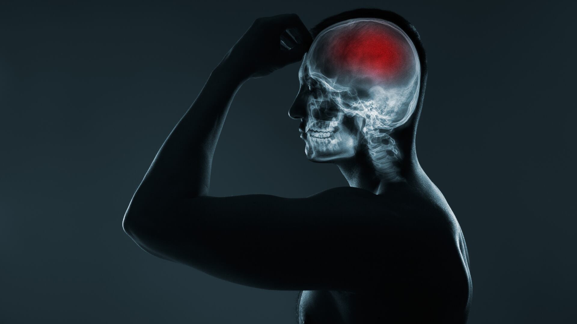 Investigación logró reducir en 75% el avance de una enfermedad sin cura mediante un tratamiento genético inyectado al cerebro