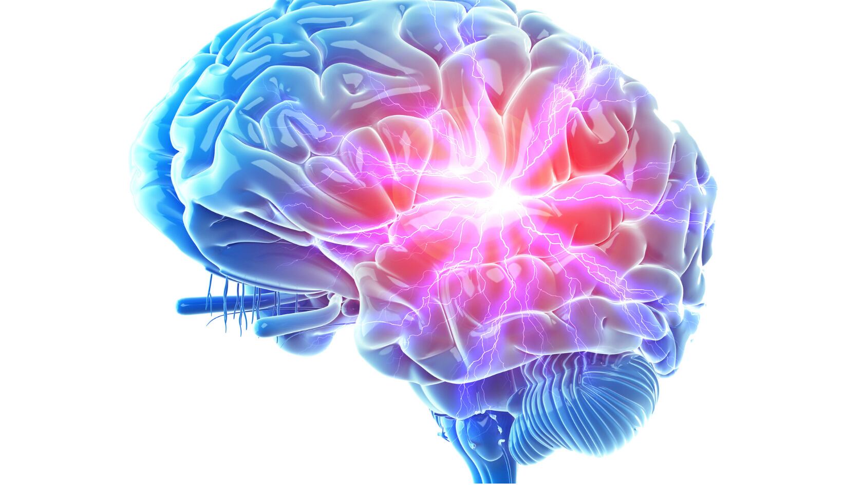 Investigación internacional encontró cambios estructurales del cerebro en edades específicas que podrían explicar el riesgo de deterioro cognitivo.