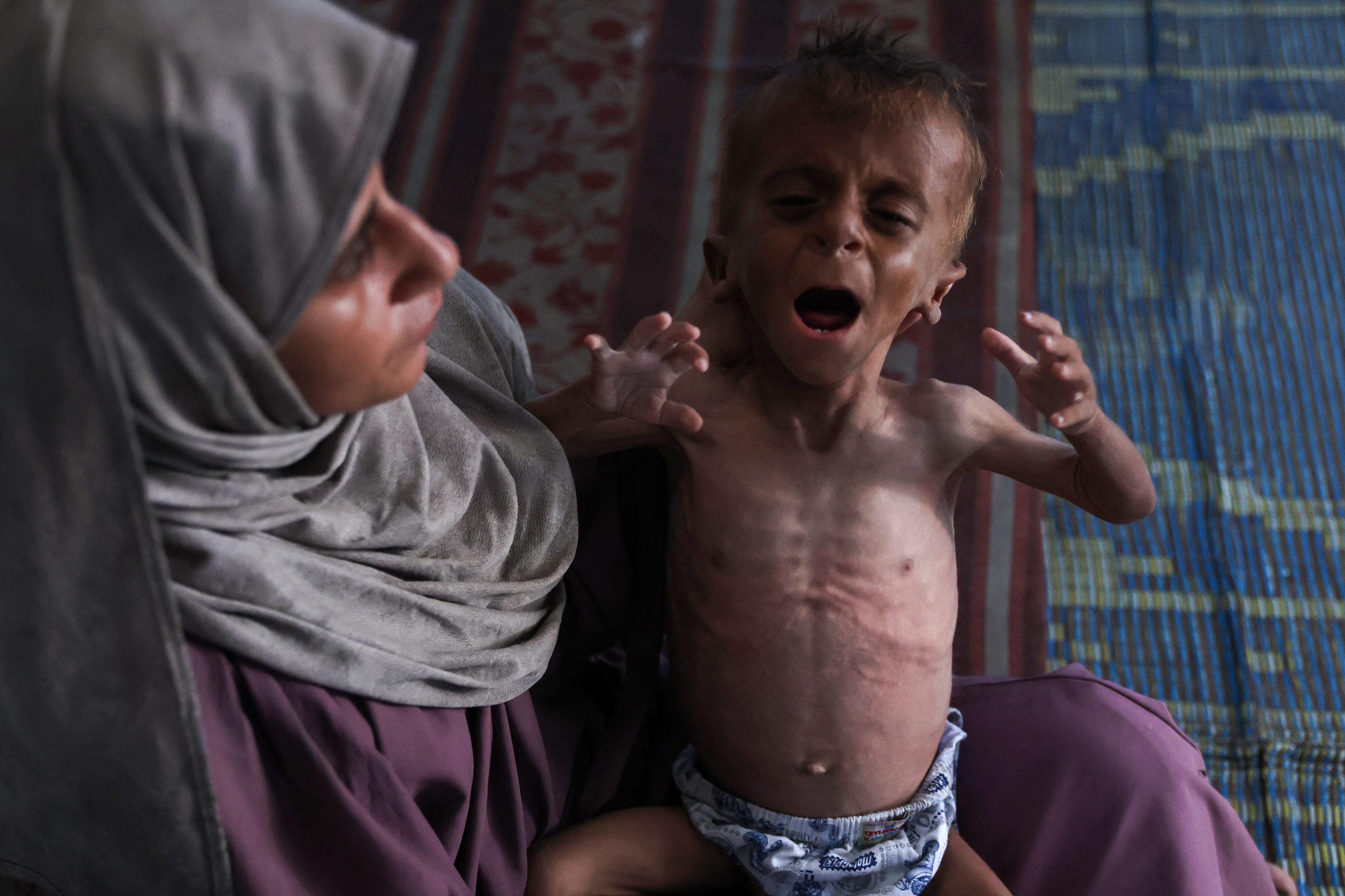 Hidaya, madre de 31 años, con su hijo de 18 meses, Mohammed al-Mutawaq, quien muestra signos de desnutrición en el campo de refugiados Al-Shati, al oeste de Gaza.